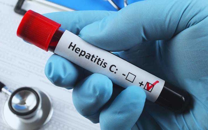 HCV Screening and Treatment: Critical for High-Risk Chronic Kidney Disease Patients